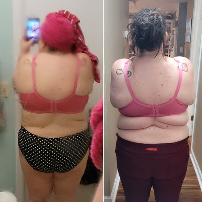 3 days post op AirSculpt for back bra roll area - loving results 