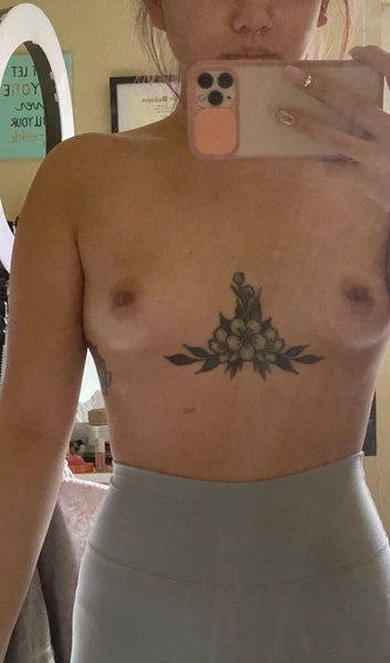 23 yo Asian, from 32A/AA to C cup - Review - RealSelf