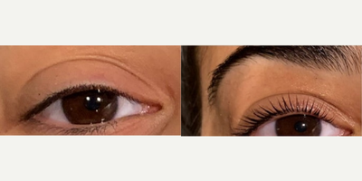 Woman treated with Yumi Lash Lift - Woman treated with Yumi Lash Lift