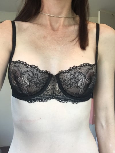 36 y/o, 5'8, 46 kgs, post-op, 275cc silicone smooth round
