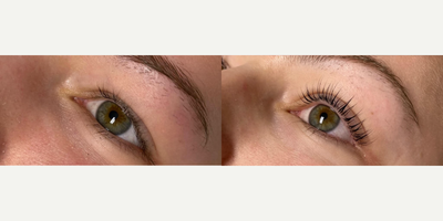 Woman treated with Lash Lift - Woman treated with Lash Lift.