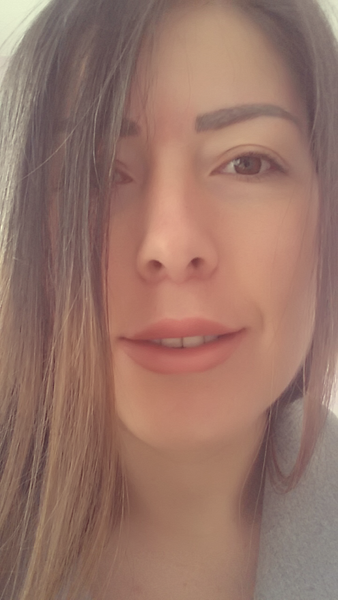 He Does Art Not Surgery Metin Kerem Md Review Realself