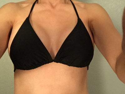 5'0, 96 lbs, 2 kids, From 32A to 32D - Review - RealSelf