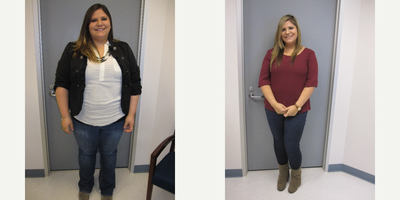 Before & After - 6 months post-op