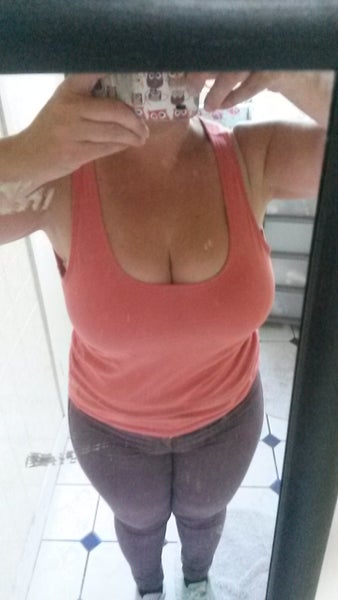 Breast Reduction 34HH to ?? - Review - RealSelf