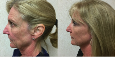 before and after image
