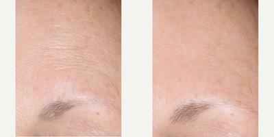 Skinbetter Science - AlphaRet Overnight Cream.Photo provided courtesy of Skinbetter Science.