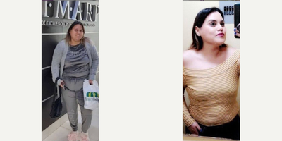 18-24 year old woman treated with Orbera Gastric Balloon - 18-24 year old woman treated with Orbera Gastric Balloon