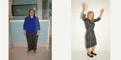 45-54 year old woman treated with Gastric Balloon - Diagnosed with high blood pressure and at risk for a stroke, she looked all over for a surgeon who could help.