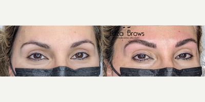 Woman treated with Microblading - Woman treated with Microblading