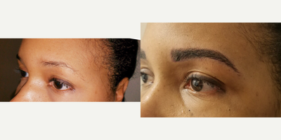 25-34 year old woman treated with Permanent Makeup - MicroBlading Before and After pictures by Dr. Deborah Sillins of Rejuvene Plastic Surgery in Northern Kentucky and Cincinnati.