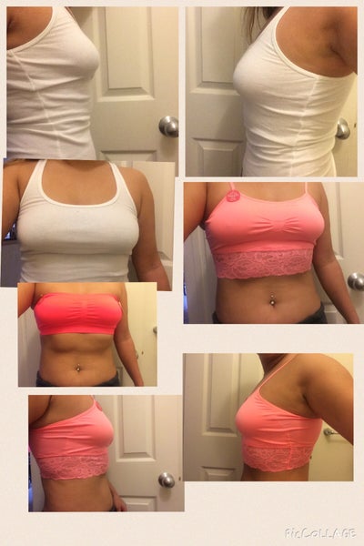 5'5 122lbs, 34B to 34DD, 400cc, mod +1 year post op - Review 