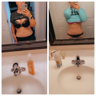 I was never ashamed of my wiggly, magical belly after having three kids and  losing 130lbs - but I'm so happy with my tummy tuck