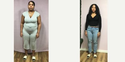 25-34 year old woman treated with Endoscopic Sleeve Gastroplasty - Our patient lost 61 Lbs in 5 months after the Endoscopic Sleeve Gastroplasty procedure.