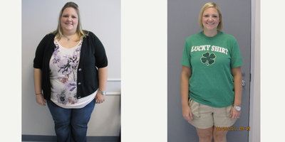 35-44 year old woman treated with Gastric Bypass - Before surgery, 343.6 lbs, 55.1 BMI. One year after surgery, 180.6 lbs, 29.6 BMI.