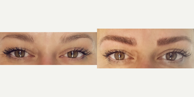 35-44 year old woman treated with Permanent Makeup - MicroBlading Before and After pictures by Dr. Deborah Sillins of Rejuvene Plastic Surgery in Northern Kentucky and Cincinnati.