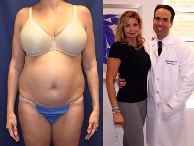 40 Year Old Mother Of 3 Beverly Hills Ca Review Realself Durable and advanced plastic shrink wrap at awesome prices from trusted suppliers. beverly hills ca review