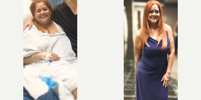 Woman treated with Gastric Bypass - My amazing patient decided to completely change her life- very proud of all the progress he has made.Special thanks to all of my amazing patients who let us share their story and inspire so many others.