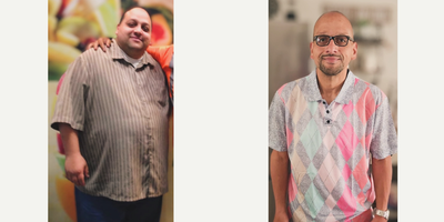 Man treated with Gastric Sleeve Surgery - Dare to make this great change, in the hands of the expert, with Dr. Jorge Maytorena.My team and I are 100% committed to each patient, you can be sure that we will offer you a quality, safe, and effective surgery.