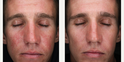 Skinbetter Science - AlphaRet Professional Peel System.Photo provided courtesy of Skinbetter Science.