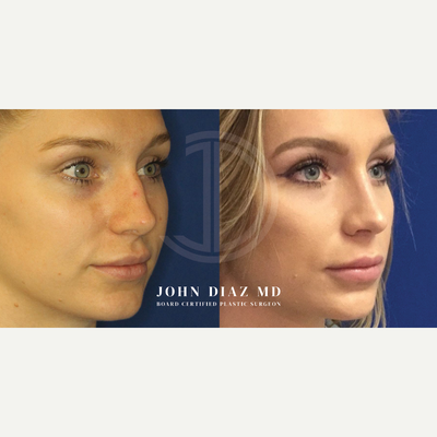 before and after image