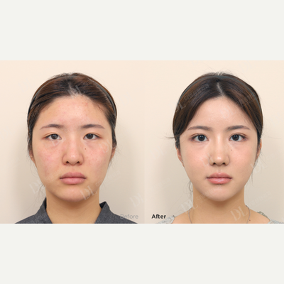 before and after image