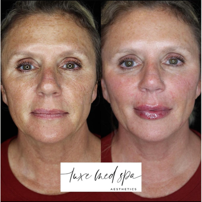 NovaThreads before and after photo