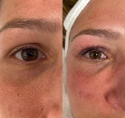 Woman treated with Lash Lift - Woman treated with Lash Lift