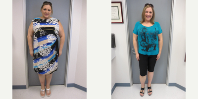 25-34 year old woman treated with Duodenal Switch - Before surgery, 319.4 lbs and 44.6 BMI. 9 months post op, 227 lbs and 31.8. A total loss of 92.4 lbs and a decrease of 12.8 BMI points.
