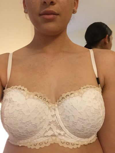 Breast reduction 34GG to D/C - Review - RealSelf