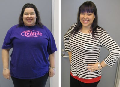 Before & After - 
	9 months post-op
