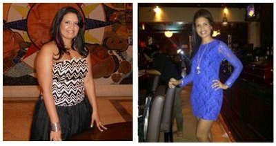 25 years old female, treated with sleeve gastrectomy - 25 years old female ,  treated which with a  sleeve gastrectomy. she had 210 pounds at the time of surgery, with obesity associated diseasses . this it is  her  three years after  surgery. she  weighs 130 pounds  (down  80 pounds) and is a new and happy  person.