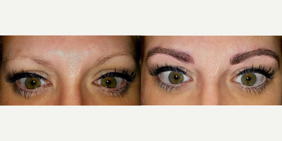 25-34 year old woman treated with Permanent Makeup - MicroBlading Before and After pictures by Dr. Deborah Sillins of Rejuvene Plastic Surgery in Northern Kentucky and Cincinnati.