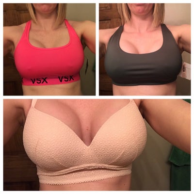 From 36NNN to DD Cup Size; A 40-Year-Old Woman's Journey To Remove