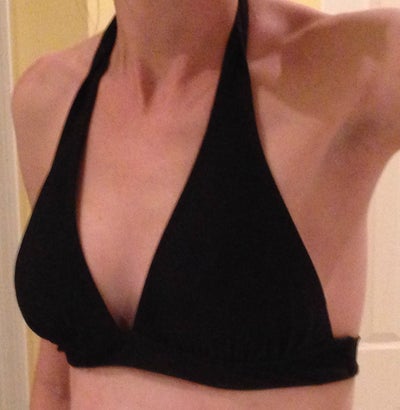 Size 30i to 30e. 824g removed. Canadian. - Review - RealSelf