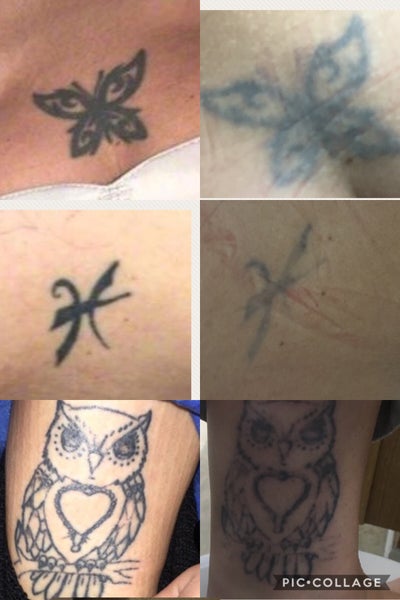 Lasercare Tattoo Removal 16410 Brooks Loop Anchorage AK Tattoos   Piercing  MapQuest