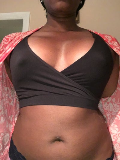 24 Years Old . 36A to 36D I Love my New Boobies - Review - RealSelf