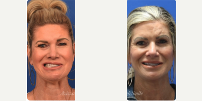 Facial Reconstructive Surgery - Facial Reconstructive Surgery