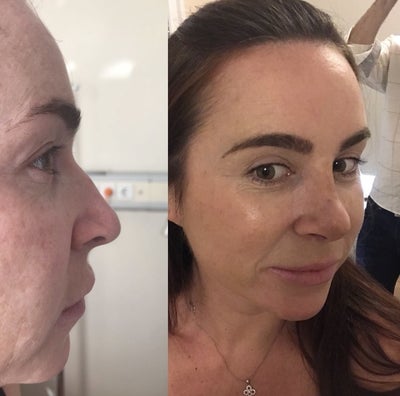 Amazing Surgeon Dr Bora Bora Ok Md Review Realself