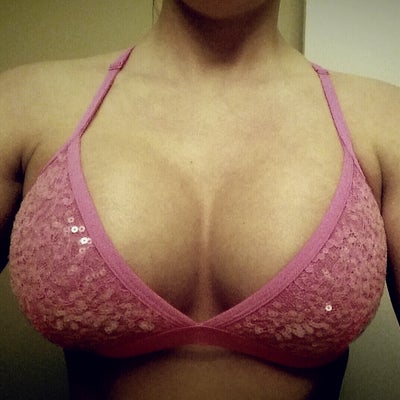 20 YO, 145 Lb, 5'3 with 34H Breasts Applying with BCBS - Review 