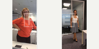 35-44 year old woman treated with Gastric Bypass - Lost 37 kgWe are proud of her