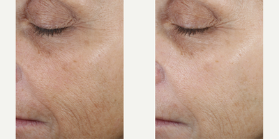 Skinbetter Science - Even Tone Correcting Serum.Photo provided courtesy of Skinbetter Science.