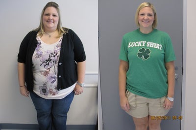 Roux en-Y Gastric Bypass - 
	Results, one year post gastric bypass.
