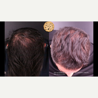 before and after image