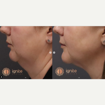 before and after image