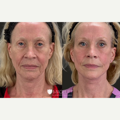 before and after image