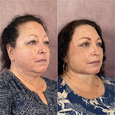 before and after image