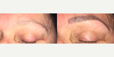 35-44 year old woman treated with Permanent Makeup - MicroBlading Before and After pictures by Dr. Deborah Sillins of Rejuvene Plastic Surgery in Northern Kentucky and Cincinnati.