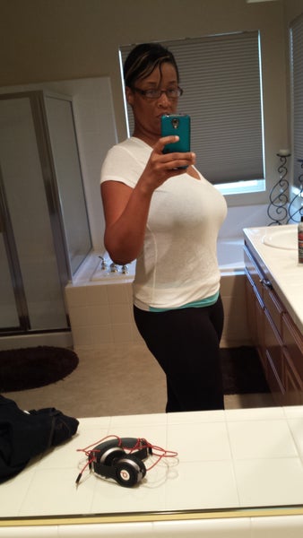 Almost 1 Year Post Op. .....loving Life! - Tummy Tuck review - RealSelf