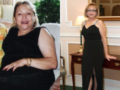 65-74 year old woman treated with Lap Band - Pre-Op Weight: 210 lbsTotal Weight Loss: 64 lbs